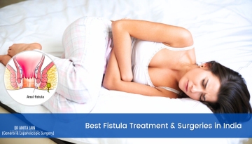 Fistula Treatment and Surgery in Delhi by Dr Amita Jain
